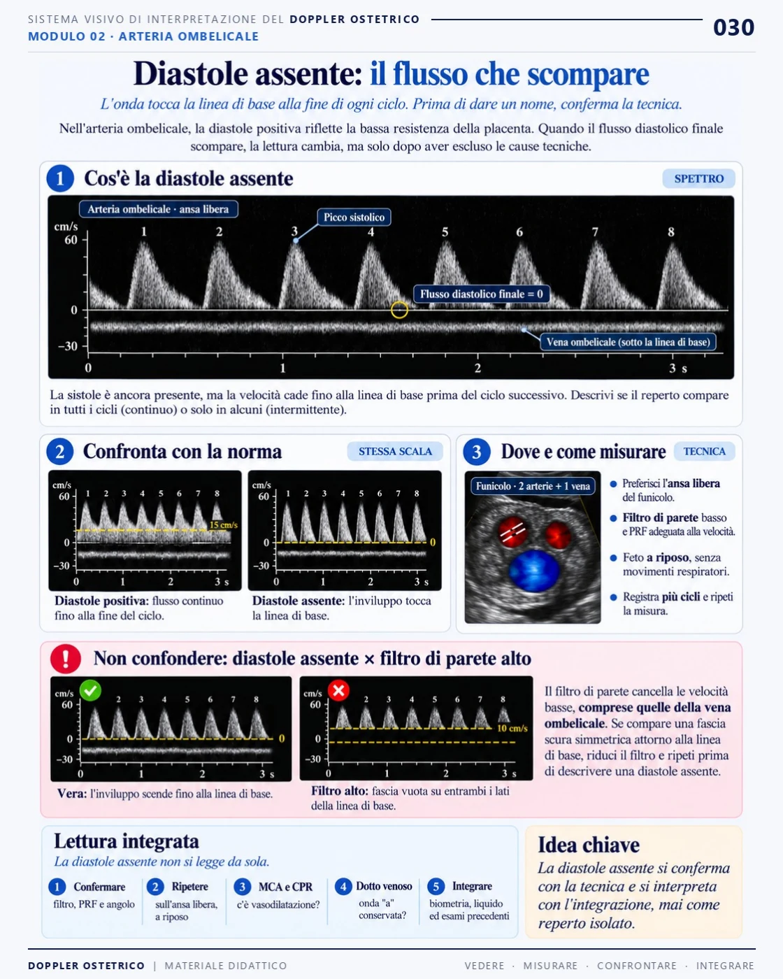 Pagina 30: Diastole assente: il flusso che scompare. Estratto dal PDF di Doppler Ostetrico e Fetale in italiano.