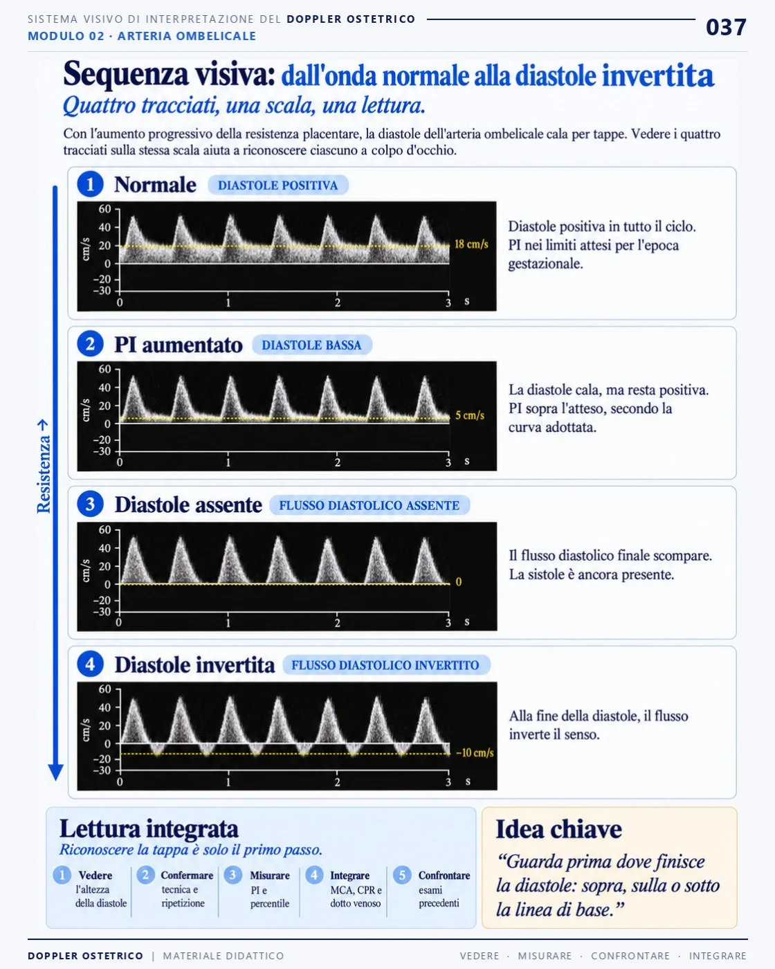 Pagina 37: sequenza visiva dall'onda normale alla diastole invertita